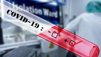 PRESJEK STANJA Danas u Crnoj Gori dvadeset osam novopozitivnih