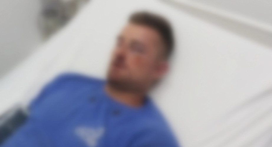 ALBANCI GA PRETUKLI DOK JE ČUVAO STOKU Nikoli su zatvorili oko i slomili nos bez ikakvog razloga!