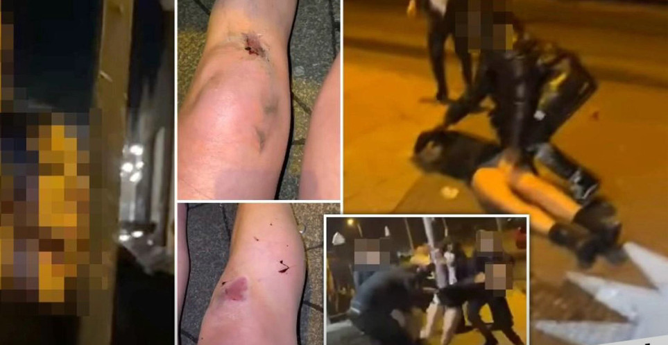 SNIMCI KOJI SU ZGROZILI SVIJET: Izbacivači tuku i vuku po podu djevojke ispred noćnog kluba (VIDEO)