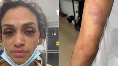 "NE MOGU VIŠE DA ĆUTIM! IMAM FRAKTURU NOSA, POTRES MOZGA, DJECA SU SVJEDOČILA": Žena NBA košarkaša optužila muža za nasilje, iznijela je jezive detalje