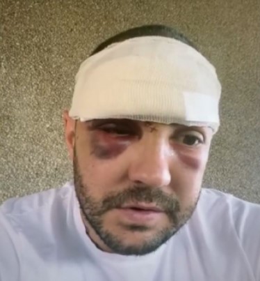 JODŽIROVA ĆERKA U BOLNICI! Čuvenog komičara iz Crne Gore poterao MALER! MOJA BEKA JE LAV NAJJAČI!
