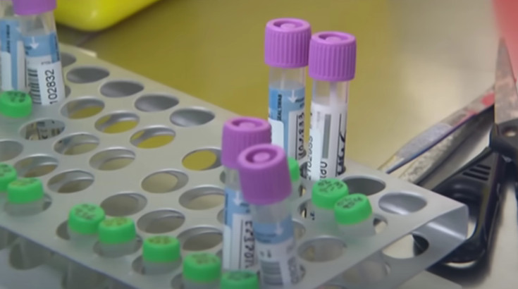 ​SZO: Epidemiju majmunskih boginja u Evropi je moguće eliminisati