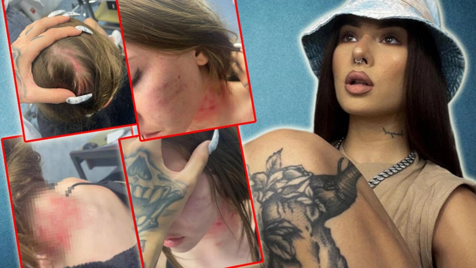 Uki Q OBJAVILA fotografiju zeta i iznijela strašne optužbe u javnost (FOTO)