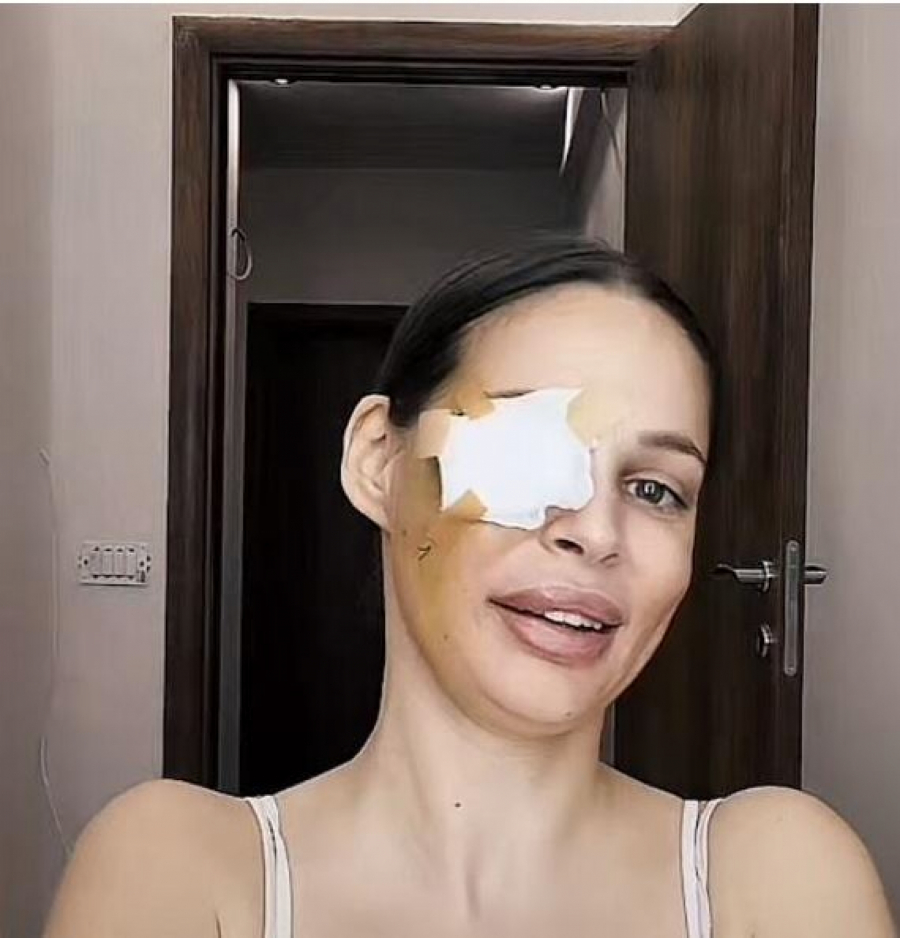 GOLO TIJELO PREKRILA ŠLAGOM Nataša Šavija nakon operacije pozirala kao od majke rođena, javnost u šoku (FOTO)