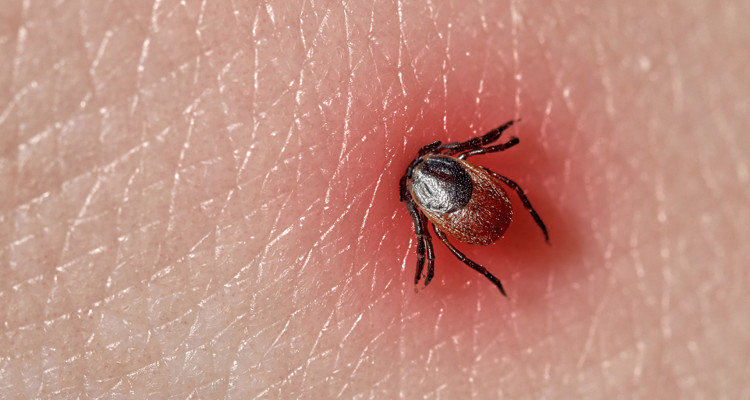 Krpelj - simptomi, liječenje i prevencija uboda