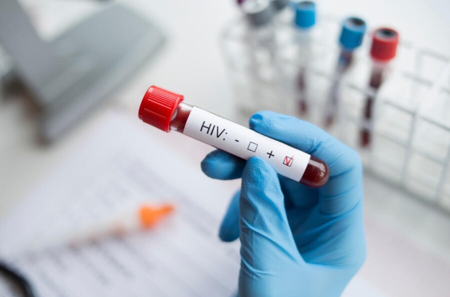 Porast broja inficiranih HIV-om u Crnoj Gori