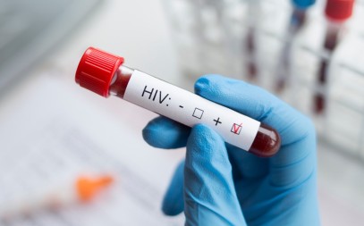 U Crnoj Gori registrovano 425 pacijenata sa HIV virusom, oko 500 osoba ne zna da je zaraženo