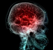 KOMPLEKSAN I SOFISTICIRAN U ovom tekstu pročitajte sve što niste znali o ljudskom mozgu