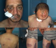 Čaki Ivanoviću država da plati samo 2.100 evra zbog brutalnog prebijanja od strane policije