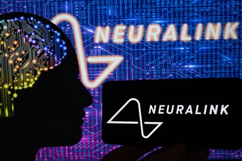 Kanada odobrila kompaniji "Neuralink" testiranje nad ljudima i ugradnju implantata u mozak