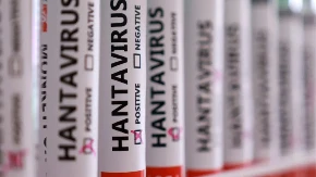 U Kvinslendu nestale epruvete sa hantavirusom