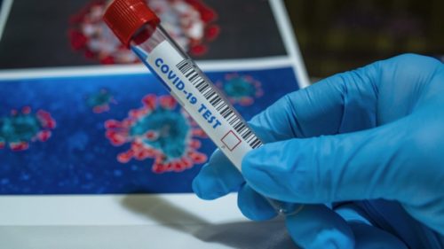 STUDIJE POKAZALE Oni razvijaju mutirane oblike koronavirusa