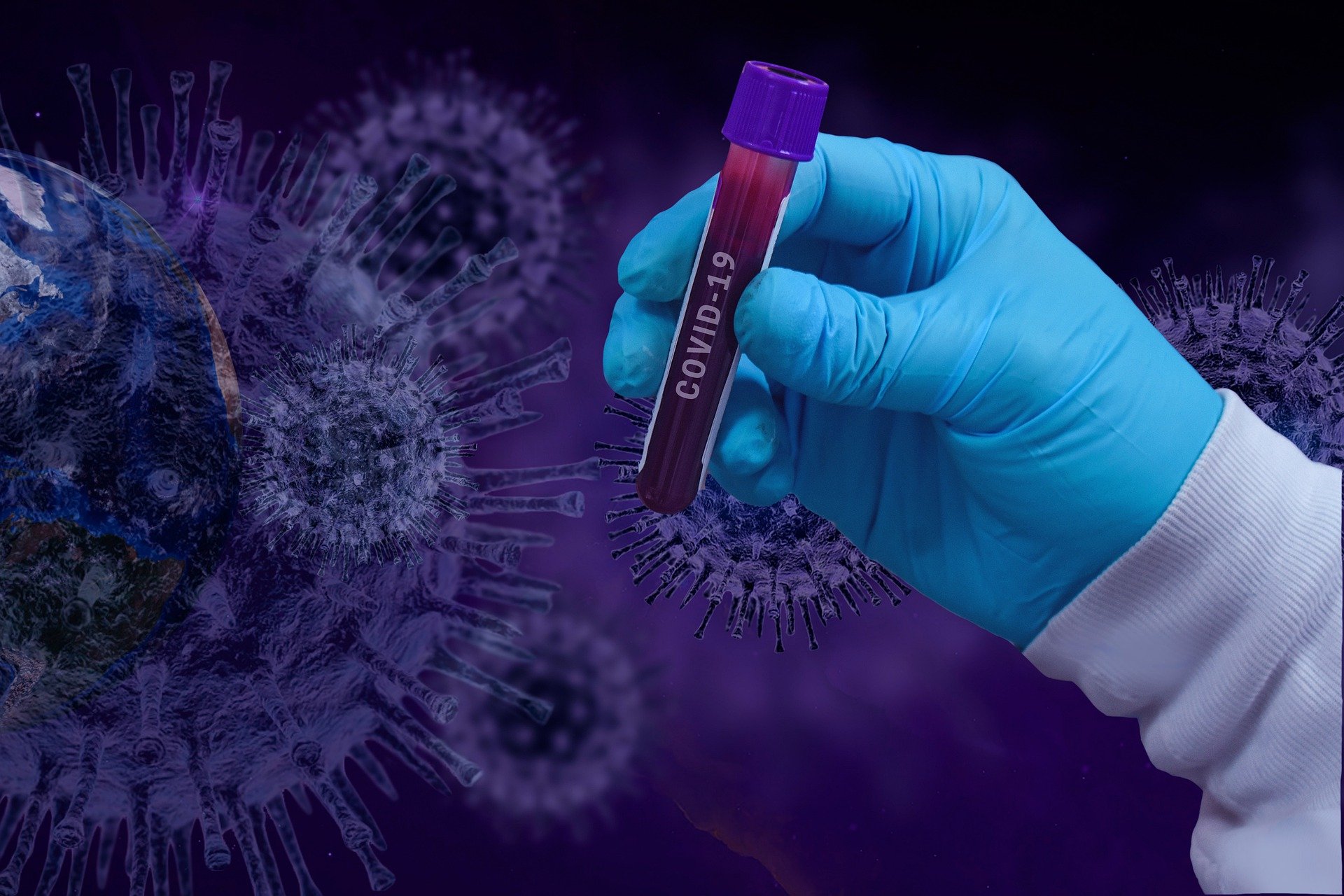 KORONA PRESJEK: 65 novoinficiranih korona virusom
