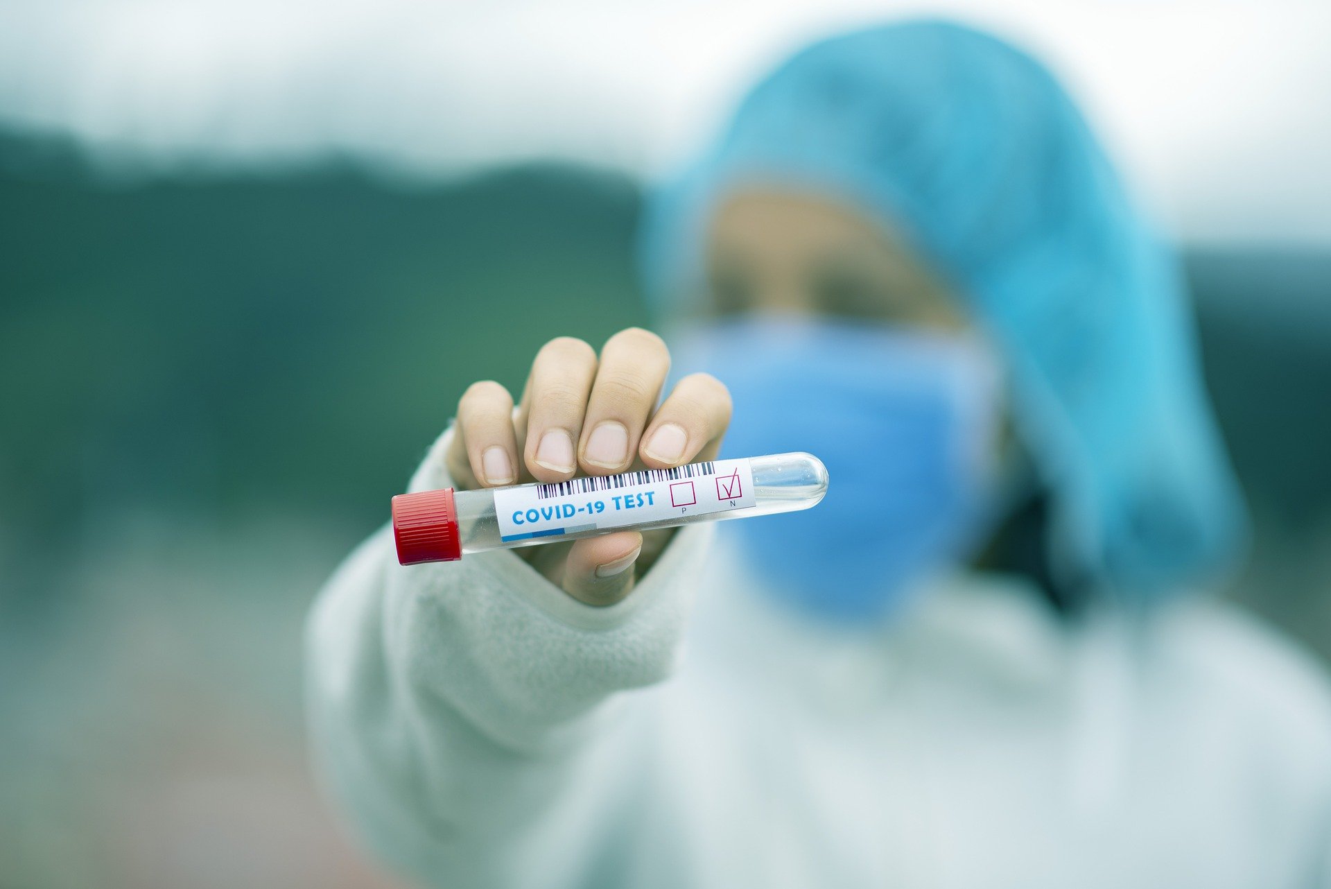 Registrovano 57 novih slučajeva infekcije koronavirusom