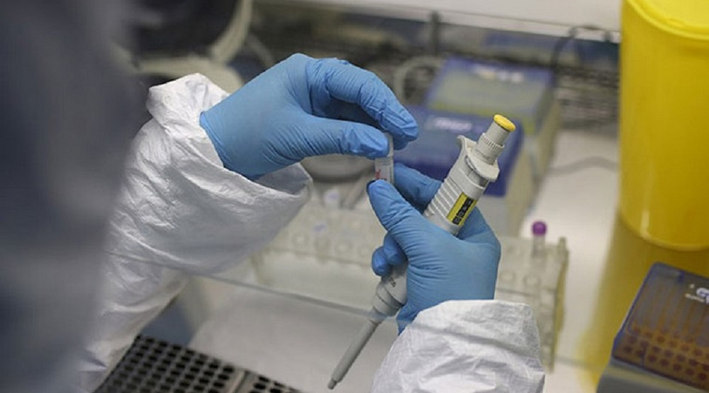 KORONA PRESJEK: IJZ: Još 44 nova slučaja koronavirusa