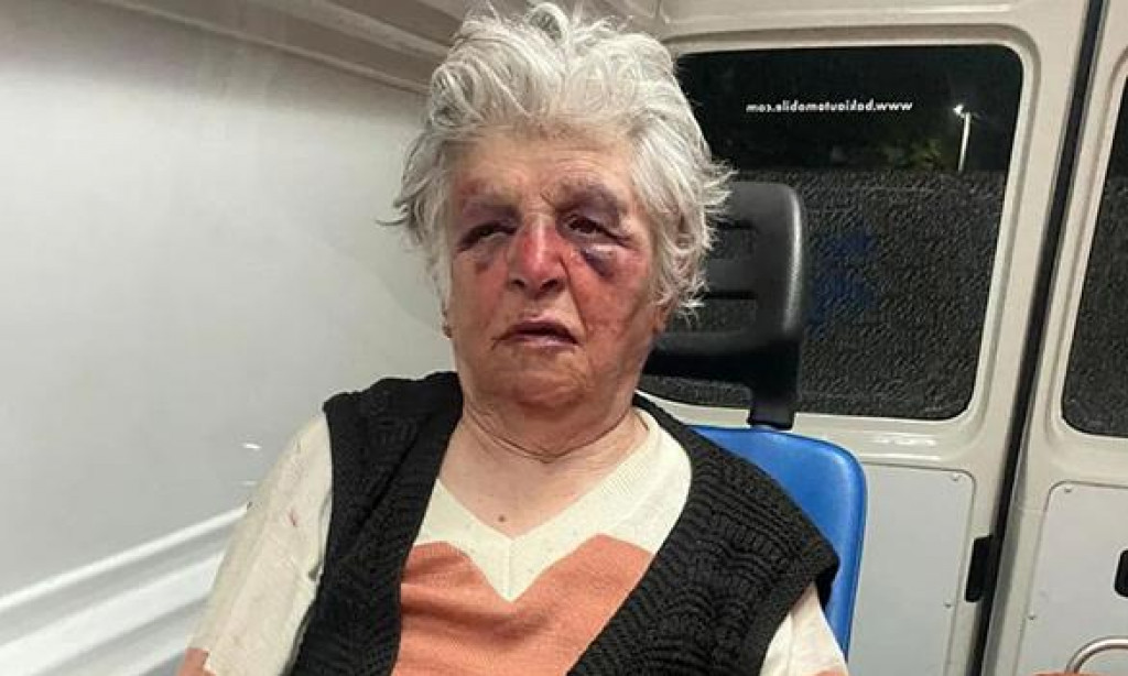 Kosovska Mitrovica: Starica pretučena u svojoj kući
