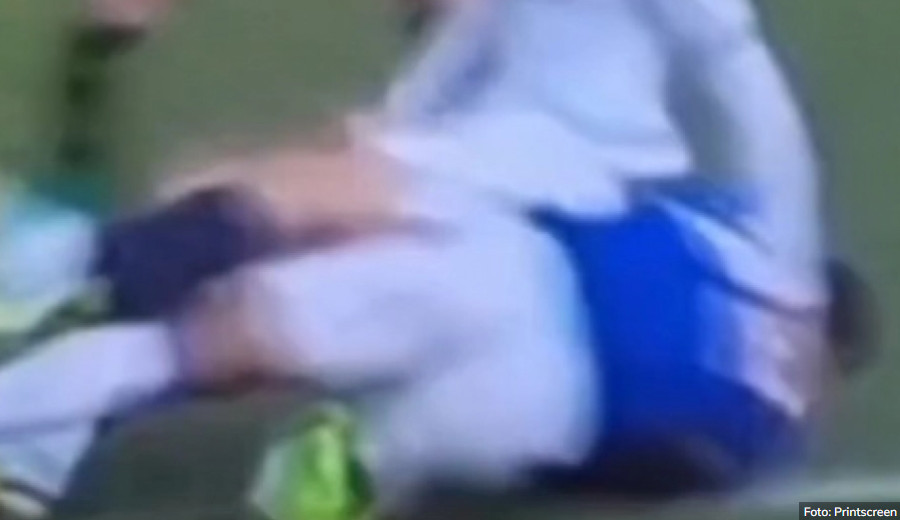 JEZIVA POVREDA ŠTOPERA Igrač Evertona iznijet na nosilima sa terena (VIDEO)
